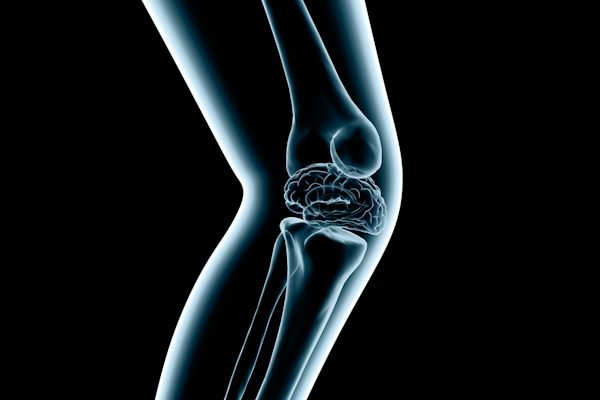 ACL Reconstruction
