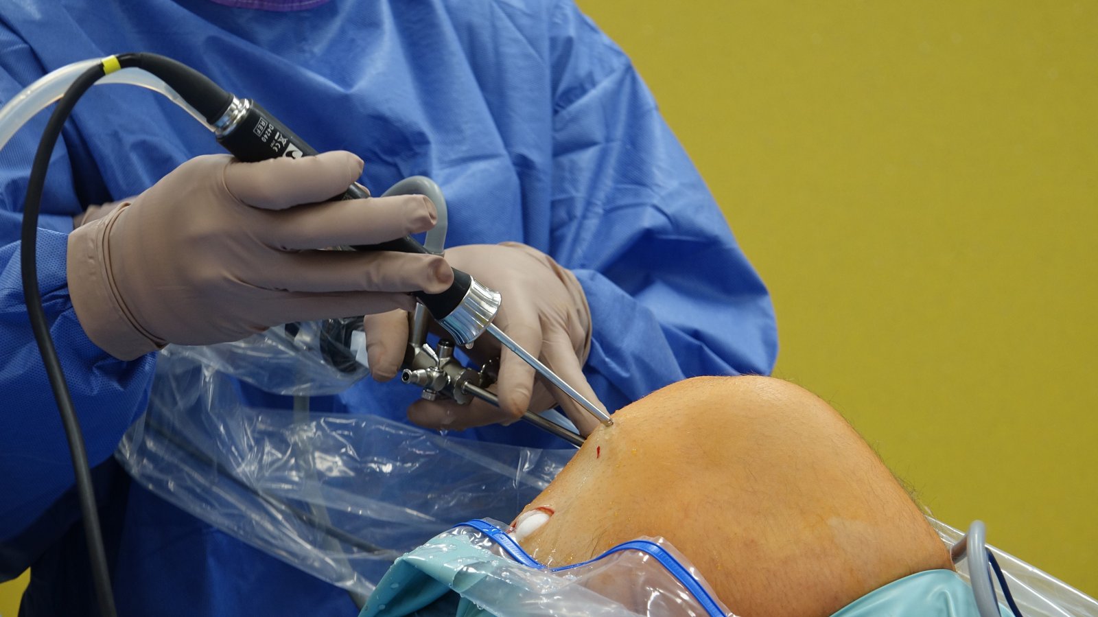 Meniscus Repair & Treatment